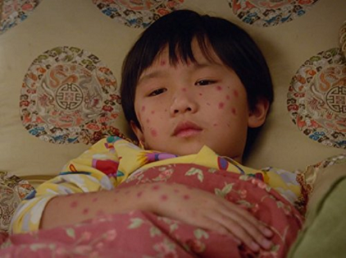 Thời điểm nào nên tiêm phòng vắc xin ngừa thủy đậu?