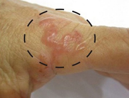 Nữ bệnh nhân ho ra những sinh vật nhỏ ngọ nguậy