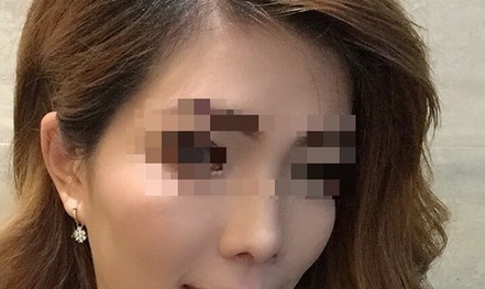 Mở băng sau cắt hàm, nữ công nhân không tin vào gương mặt mình