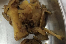 Tắc ruột vì cả lạng măng lại ngỡ đau bao tử