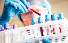 Chuyên gia lý giải vì sao ung thư gan vọt lên vị trí đầu bảng