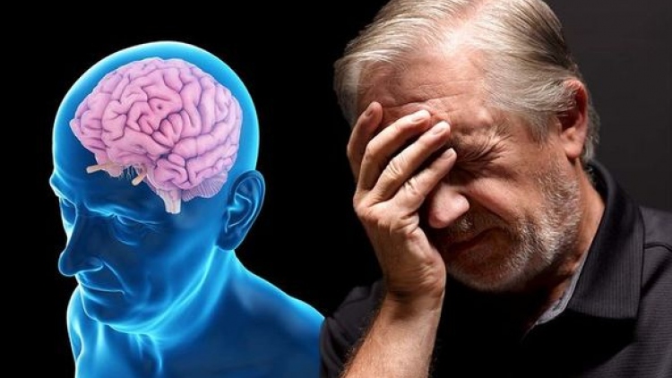Thói quen không ngờ dẫn đến bệnh Alzheimer