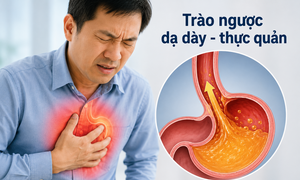 Đau ngực tưởng mắc bệnh tim, bác sĩ phát hiện 'thủ phạm' từ dạ dày